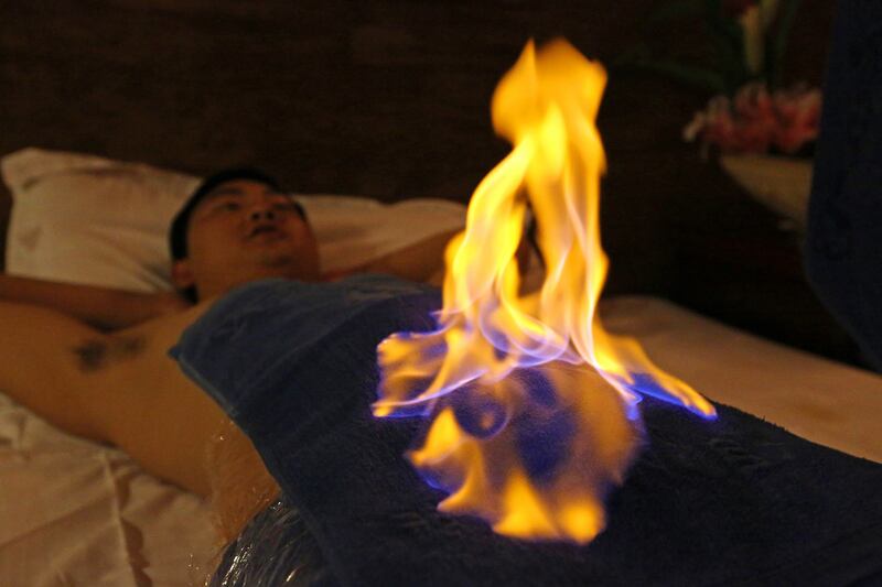 Huo liao: a man has a fire treatment in China. Photograph: VCG via Getty