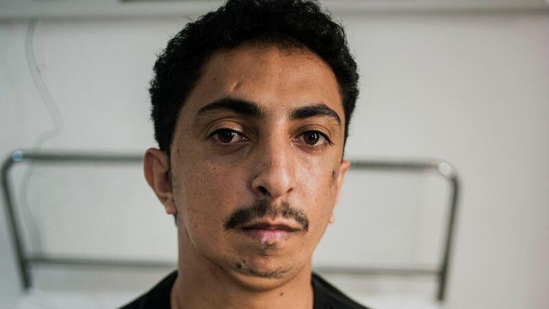 Waddah Sinan from Yemen, who underwent reconstructive surgery on his jaw, at the MSF hospital in Amman. Photograph: Ted Nieters