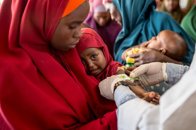 A child is screened for malnutrition at a health clinic in Baidoa, Somalia. Photograph: Sally Hayden