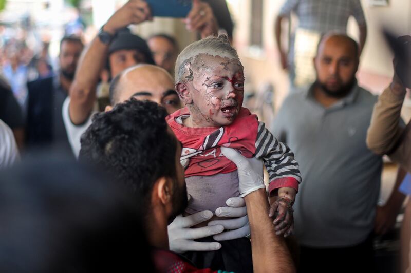 Injured Palestinian children in Khan Yunis, Gaza, on Monday after Israeli bombing raids in the southern Gaza Strip. Photograph: Ahmad Hasaballah/Getty Images