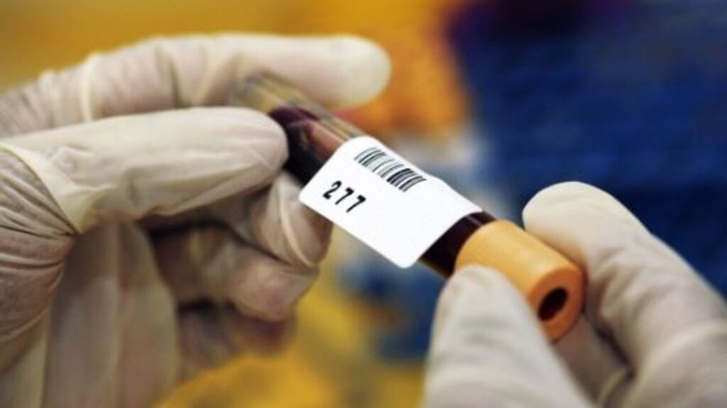 A postmortem  is due to be carried out on a man who died after an assault in Kanturk. File photograph: Getty Images