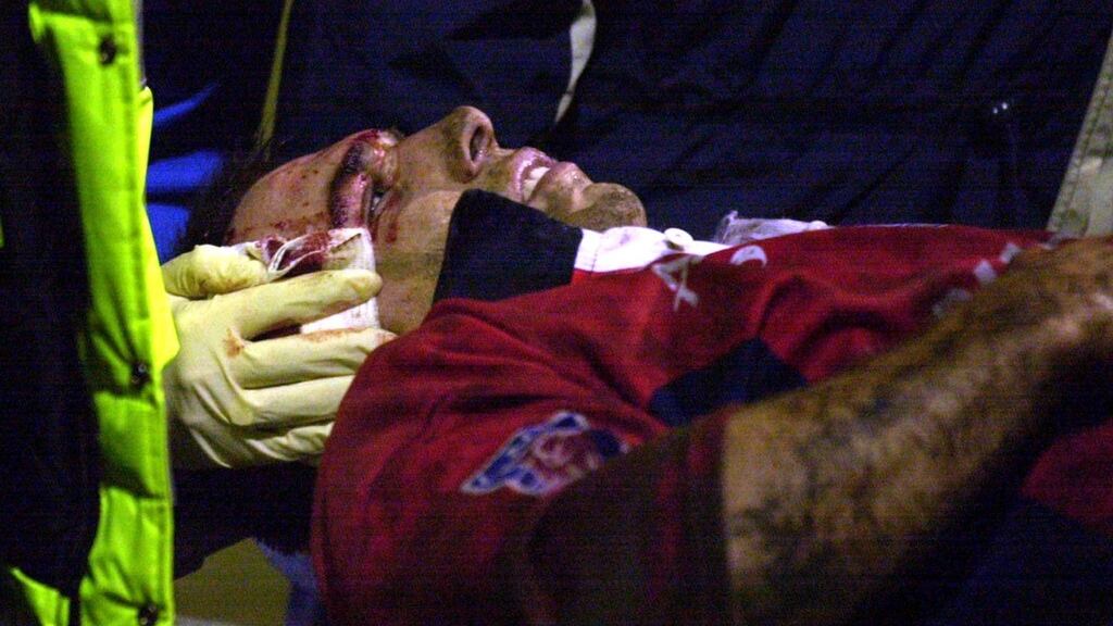 Castres fullback Romain Teulet is carried off the field with a serious head injury during the Heineken Cup in 2002. Photograph: Getty Images