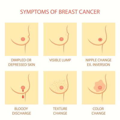 Knowing the symptoms of breast cancer is important