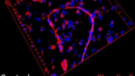 Irish-led study finds link between blood vessels and schizophrenia