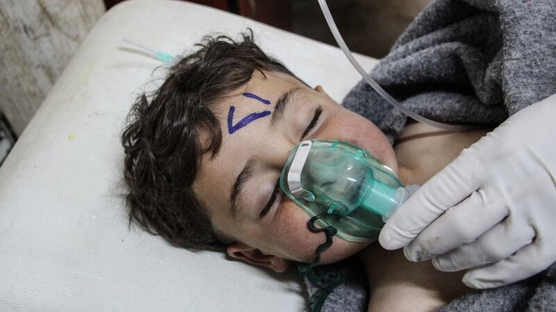 A Syrian child receiving treatment after last week’s chemical attack in Idlib province, Syria. Photograph: EPA