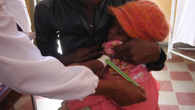 Rodas, a two-year-old girl, has her arm measured by a nurse. Its reading falls within the yellow zone, meaning that the girl is moderately malnourished. Photograph: James Jeffrey