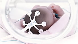 Irish firm’s device speeds up vital brain test for newborn babies