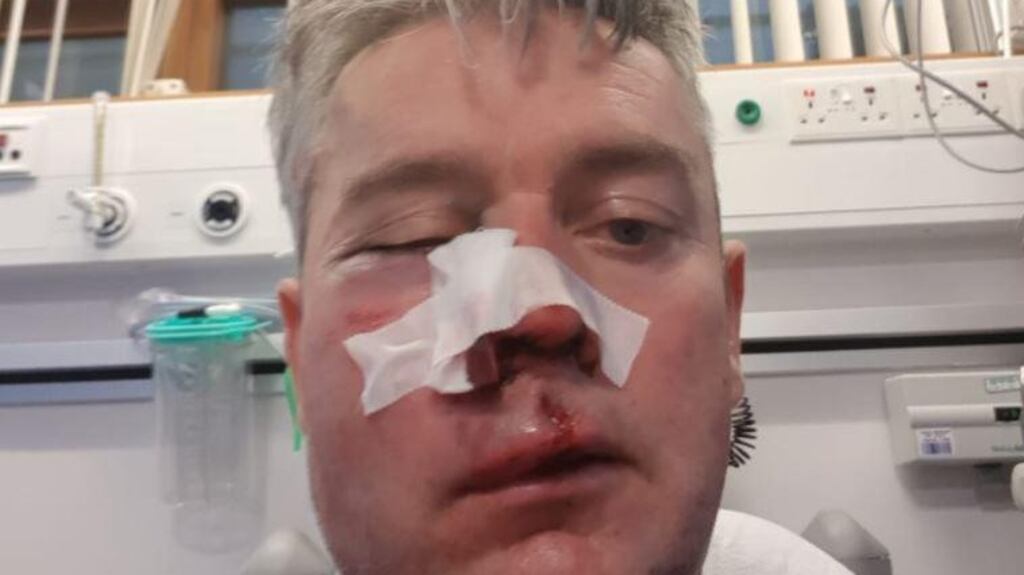 Daniel Sweeney in hospital after he was attacked following a  match between Horseleap United and Mullingar Town earlier in November.
