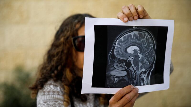 The mother of Michael  Kadar shows a scan of his head: she claims he is unfit to stand trial. Photograph: Reuters/ Amir Cohen