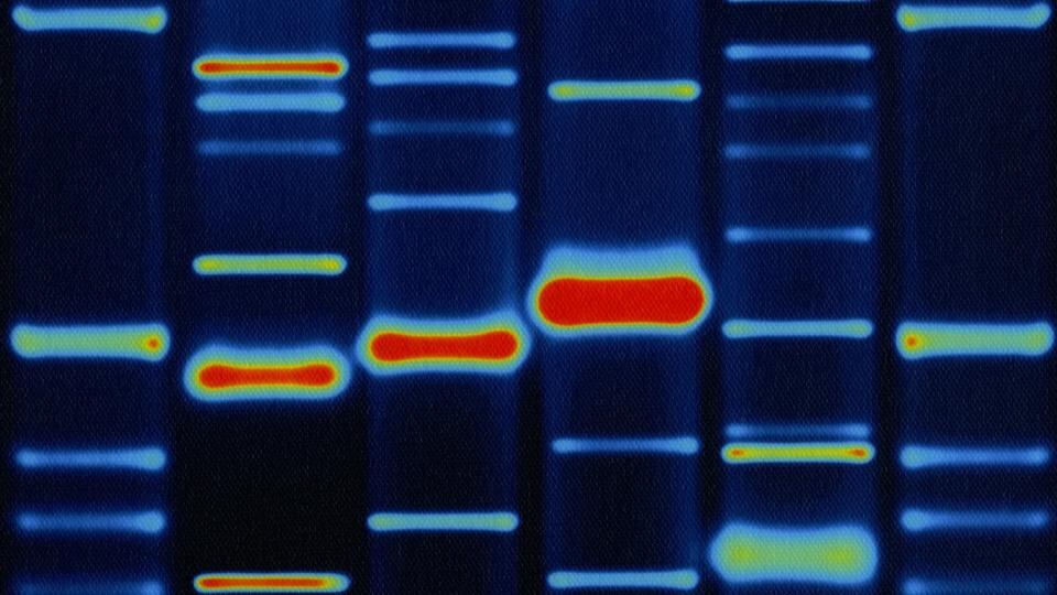 Unexpected consequences: a human DNA profile. Photograph: Seth Joel/PC/Getty Images