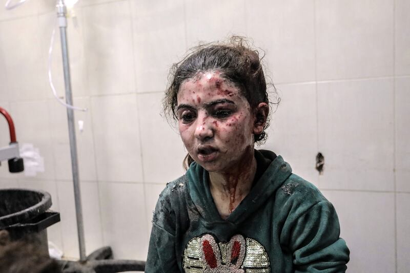 A Palestinian child injured in Israeli air strike awaits treatment at Nasser Medical Hospital in Khan Yunis, Gaza, on Thursday.(Photograph: Ahmad Hasaballah/Getty Images