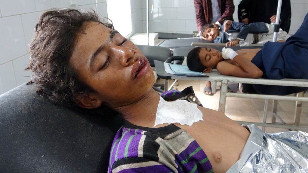 Boys injured in an air raid on a wedding party in Yemen receive treatment at a hospital in Hajjah province on Monday. Photograph: Essa Ahmed/AFP/Getty Images