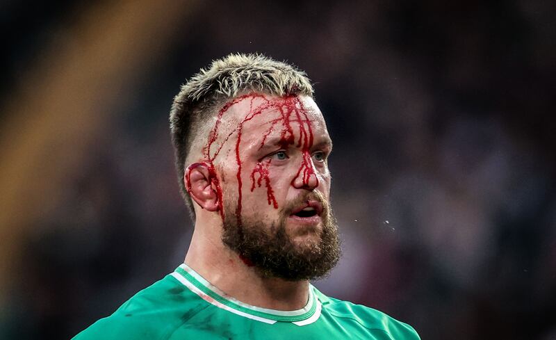 Ireland’s Andrew Porter shows the signs of battle after a difficult assignment against a fired-up England at Twickenham. Photograph: Dan Sheridan/Inpho