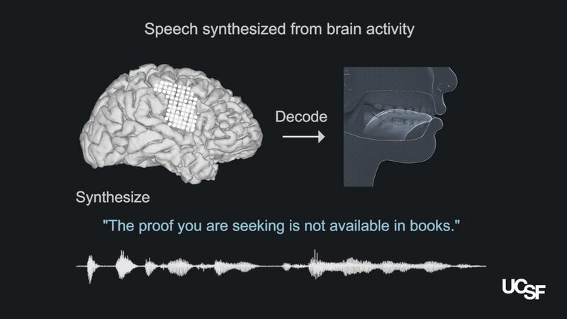 In a photo from the University of California, San Francisco, an illustration explaining a speech synthesizer. The prosthetic voice decodes what the brain intends to say and generates (mostly) understandable speech, no muscle movement needed. Still from video by Chang lab / UCSF Dept. of Neurosurgery; Simulated Vocal Tract Animation Credit by Speech Graphics
