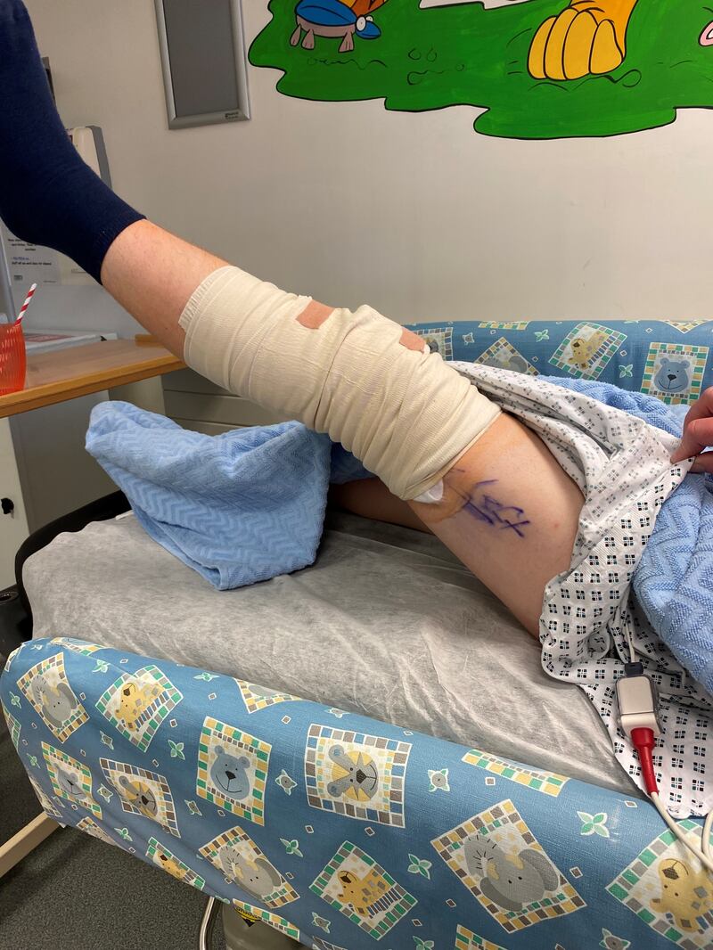 Injuries sustained by Evan Gardiner as a consequence of his falls.