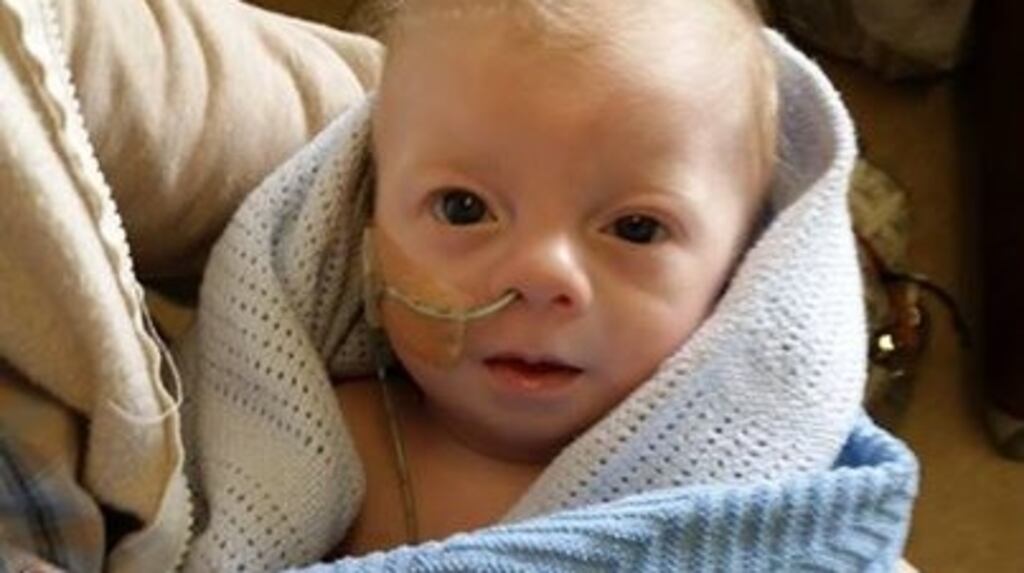 Noah Doyle, an 11-month-old who suffers from congenital heart disease.