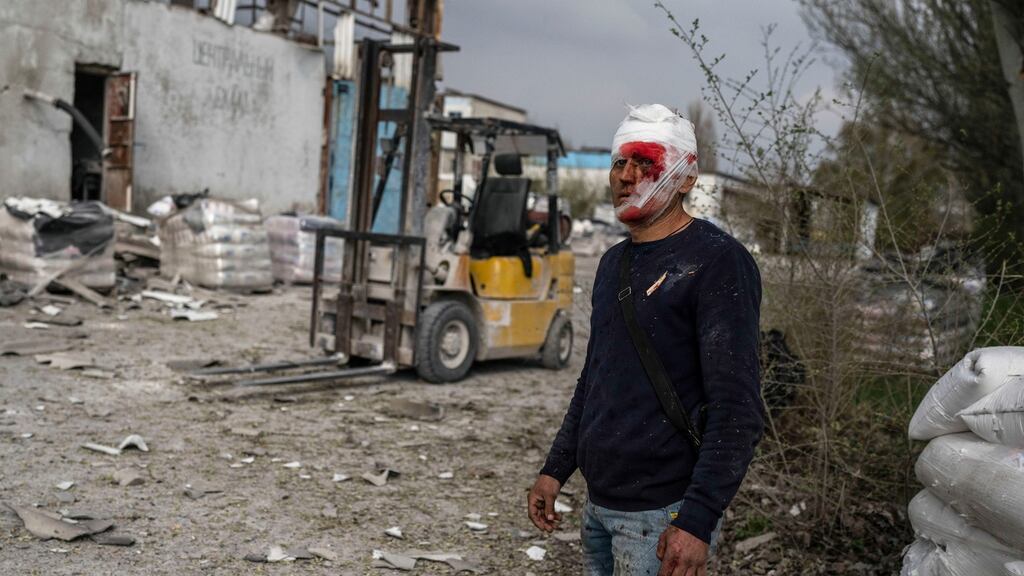 An injured man looks on following a Russian bombing of a factory in Kramatorsk, in eastern Ukraine. Photograph: Petros Giannakouris/AP Photo