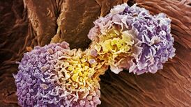 Israeli cancer treatment could be something special