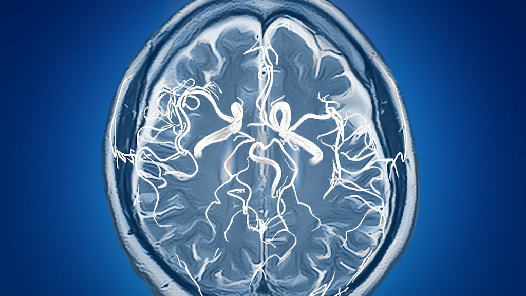 The human brain: “Self-help books started invoking neuroplasticity and saying, ‘Look! You can do anything you like with your brain’. It started grating on me. Can it really be that easy?”