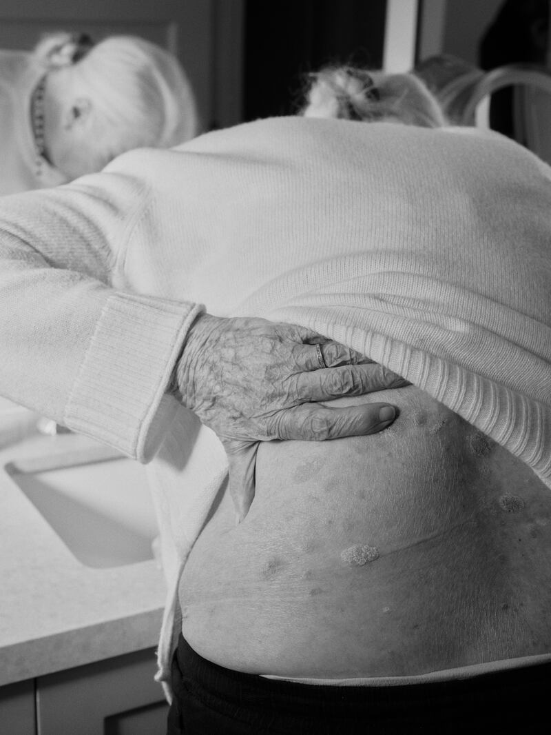 BC-WELL-LOWER-BACK-ART-NYTSF � Back pain is common and complicated. But altering your workout to build control and stability can help prevent it. (Cole Barash for The New York Times) � FOR USE ONLY WITH BC-WELL-LOWER-BACK-ART-NYTSF BY RACHEL FAIRBANK. ALL OTHER USE PROHIBITED.