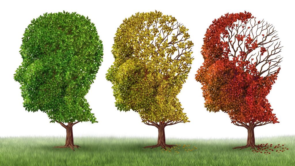 For treatments to be successful, early stages preceding full onset of Alzheimer’s need to be targeted. Illustration: iStock