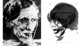 ‘Jigsaw murders’: The gruesome case of a jealous GP