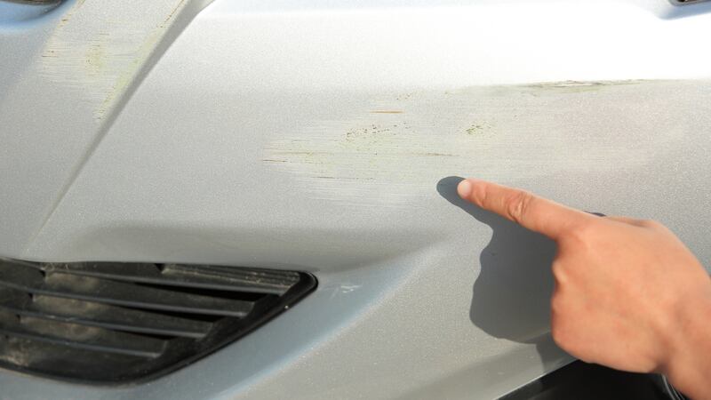 ‘Accident prone’ man faces legal bill over ‘opportunistic’ claim