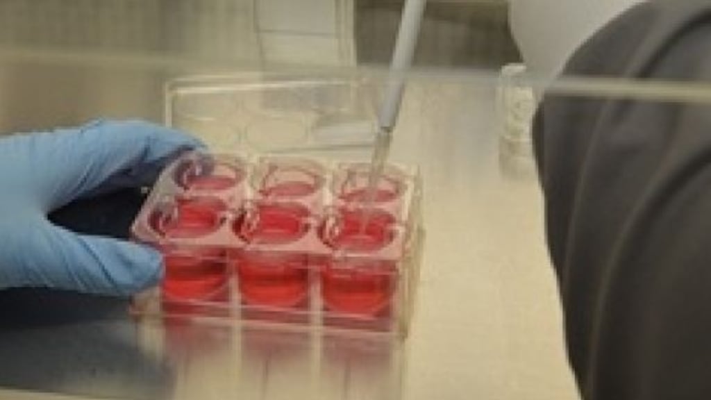 Revenue at Venn Life Sciences was boosted by the contribution of Kinesis, which the group acquired in a €6.5 million deal in October 2015.