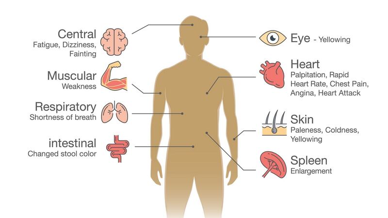 The most common symptoms of anemia