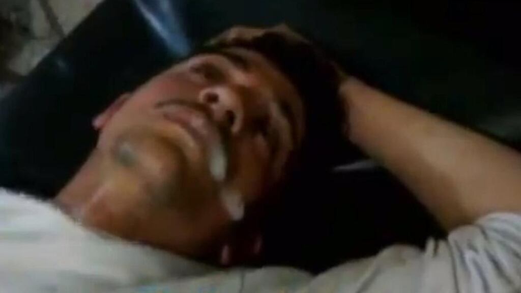 In a screen shot from amateur video provided by Kurdish network Ronahi TV, a man foams at the mouth and twitches while lying on a stretcher at a hospital in Syria. The video is consistent with reporting of an attack in the Sheikh Maqsoud neighborhood in Aleppo on April 13th, although it was not known if the symptoms resembled those triggered by a chemical weapons attack. Photograph: AP Photo/Ronahi TV