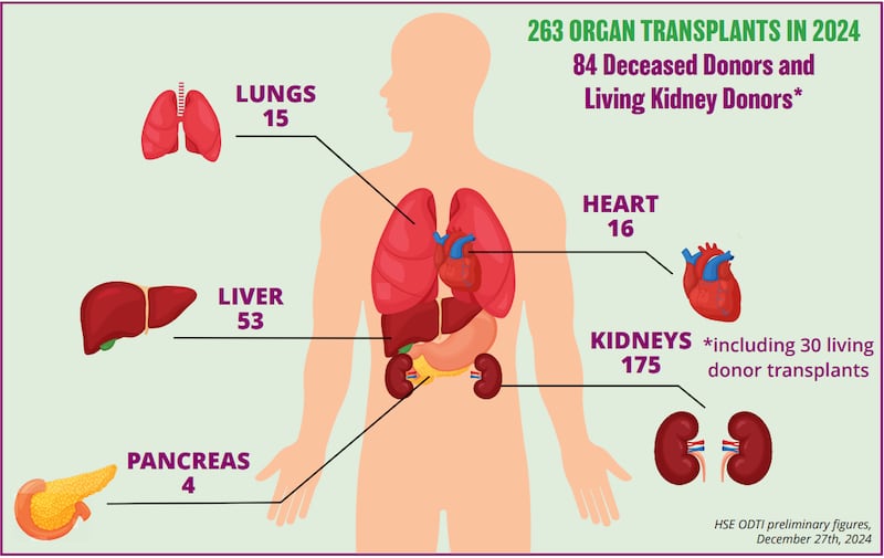 Source: Organ Donation Transplant Ireland/HSE