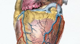 Waterford hospital: What is a cath lab?