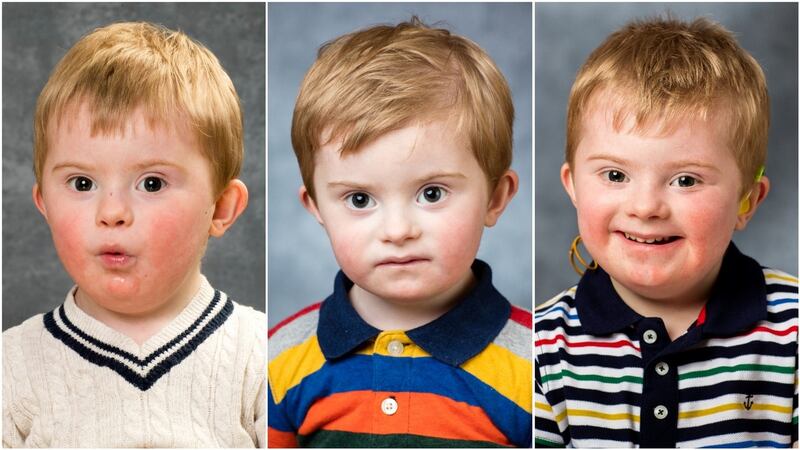 Simon photographed in 2016, ’17 and ’18. Simon has a sister, Georgina (2).