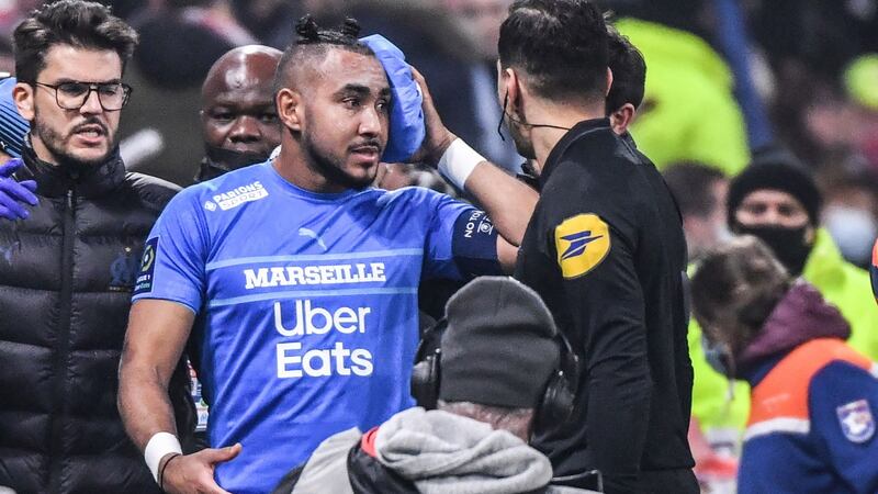 Payet was left with an injury to the head. Photo: Philippe Desmazes/AFP via Getty Images