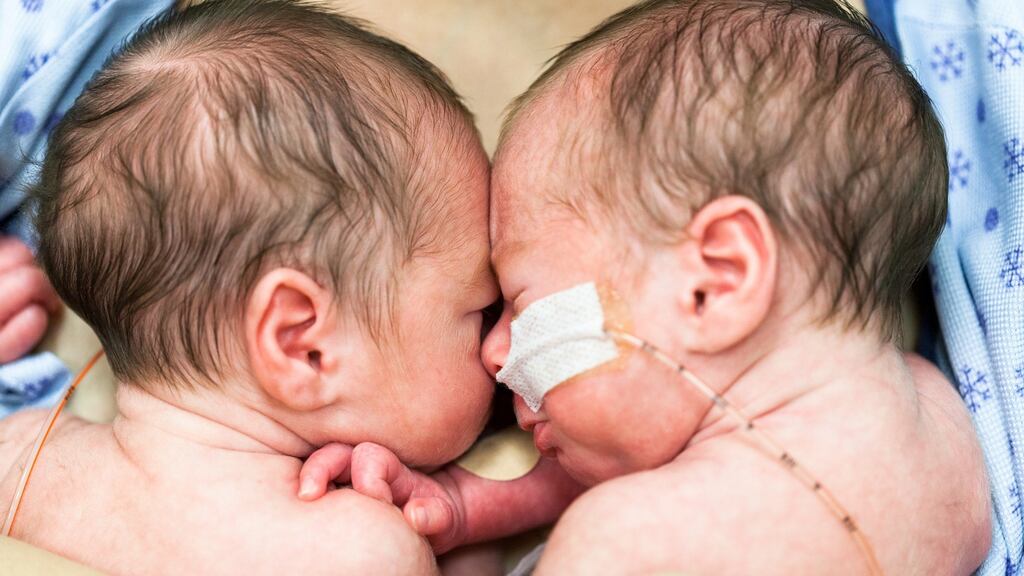 ‘The absolute number of twin deliveries has increased everywhere except in South America.’ Photograph: iStock