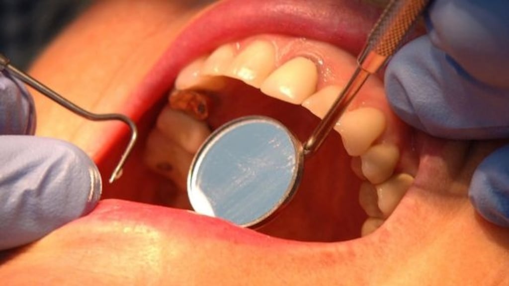 The Department of Employment Affairs and Social Protection is forecasting a 38 per cent increase in dental examinations in 2018. Photograph: John Giles/PA Wire