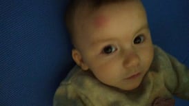 Father and daughter hurt in incident with scrambler bike