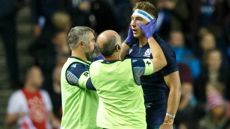 Jamie Ritchie of Scotland is treated for a facial injury during their World Cup warm-up victory over Georgia. Photo: Robert Perry/Getty Images