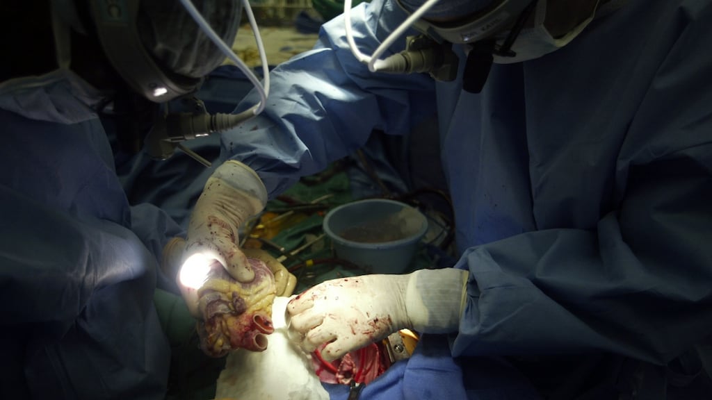 Heart transplant surgery. Photograph: Lea Suzuki/The San Francisco Chronicle via Getty