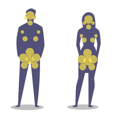 HS can affect any part of your body