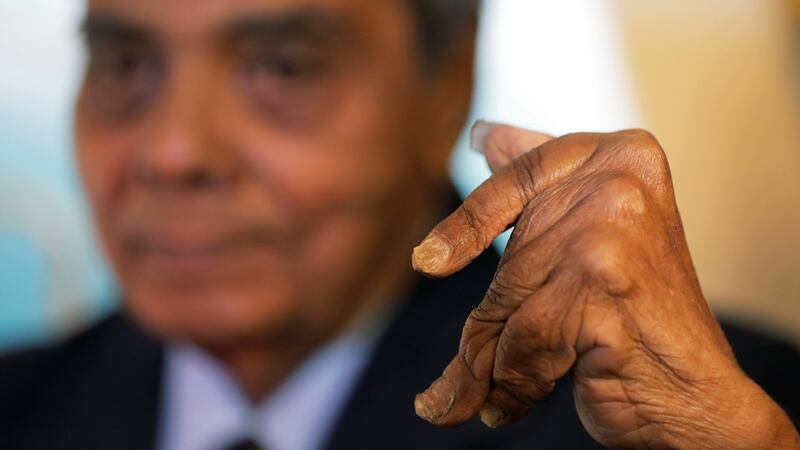 Shridhar Chillal of India displays his newly cut fingernails. Photograph: Lucas Jackson/Reuters