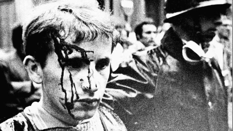 A bloodied student after clashes in Paris in May 1968: Many of my friends in Paris were teenagers in May 1968, and the experience marked them. Photograph: AP Photo