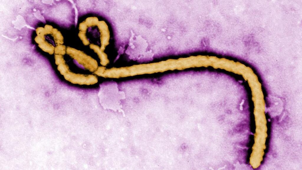 The development marks the first such success against the strain of Ebola that killed up to 10,000 people in West Africa’s 2014-2015 outbreak. Photograph: Frederick Murphy/CDC/PA Wire