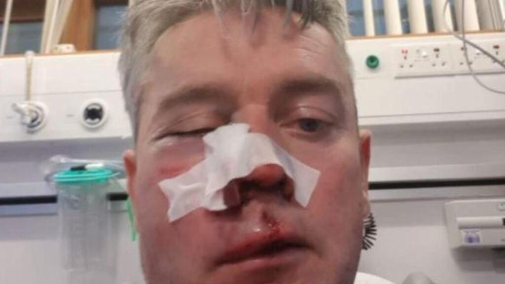 Referee Daniel Sweeney in hospital following the attack.