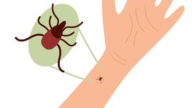 After headaches, fatigue, brain fog, insomnia and sore throat, ‘it dawned on me – could it be the tick?’