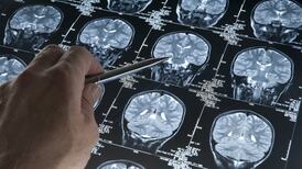 Spatial tests could reveal early sign of Alzheimer’s, says expert