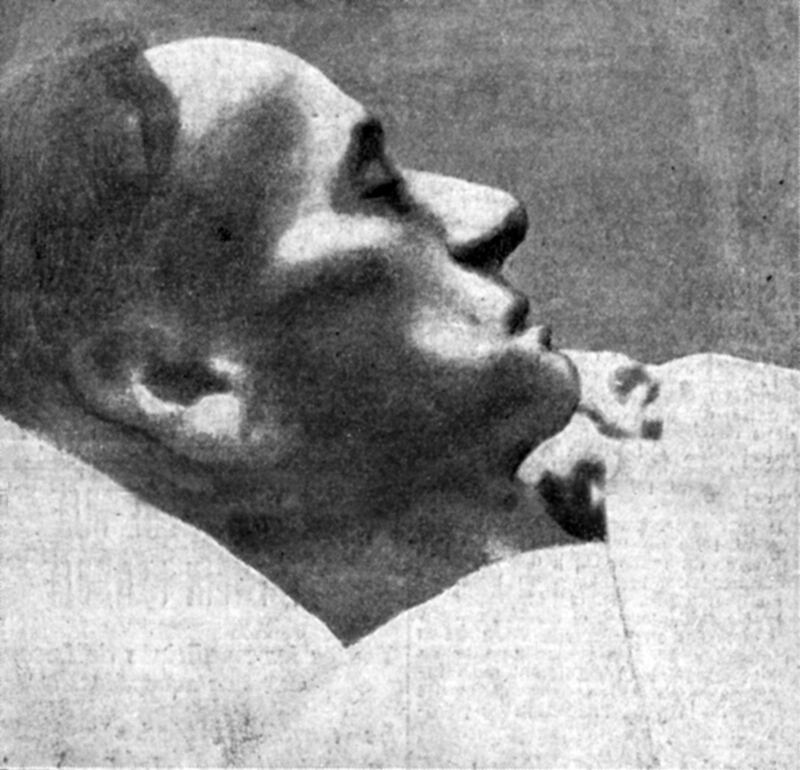 The emaciated face of Terence MacSwiney, in a photograph published by a French newspaper under the heading: ‘The Lord Mayor of Cork Two Days Before His Death’. Photo Credit: UCD Archives)