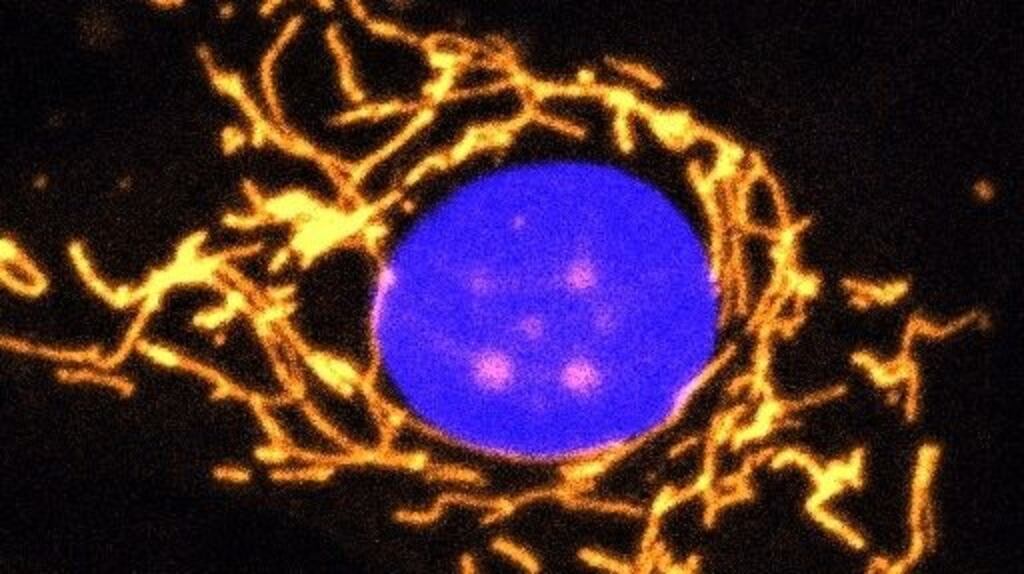 A fluorescent microscope image of a healthy cell with its mitochondria highlighted in gold. It shows a highly elaborate and well-connected network of mitochondria. Image:  Prof Jane Farrar and Dr Daniel Maloney, Trinity College Dublin