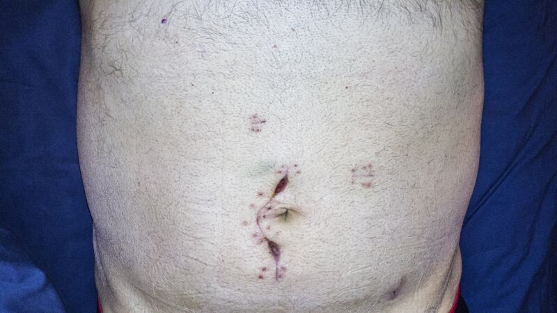 It is not only the change in appearance, but also pain, discomfort, and a loss of bodily control which can significantly alter how someone views themselves. Photograph: iStock