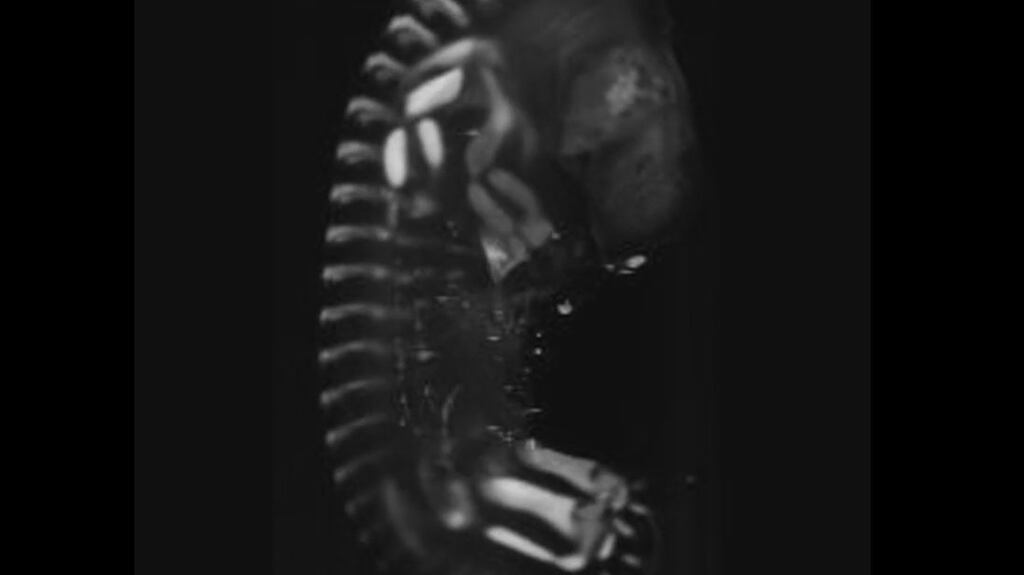 A three dimensional image that helps to visualise the developing baby’s bones and joints. Image via TCD